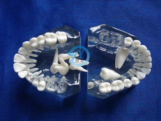 标准水晶牙列模型(全口牙可拆)