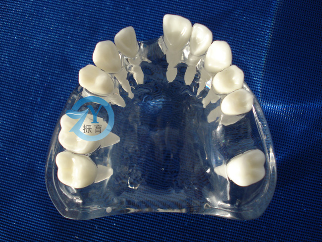 水晶牙列缺失模型（白色牙齿）