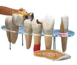 齿科形态学系列模型(实物的10倍)7部分-英文注释