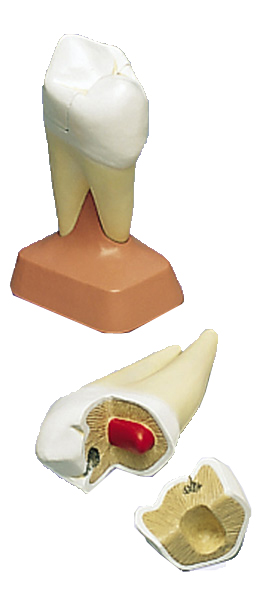 进口上颌两根龋臼齿模型(2部分)-德国3B-VE299