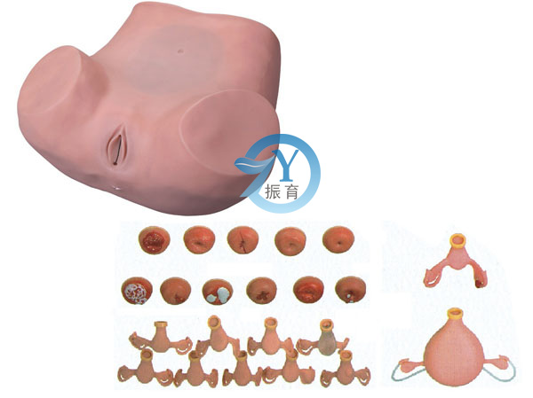 高级妇科检查训练模型