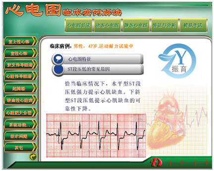 新版心电图教学软件