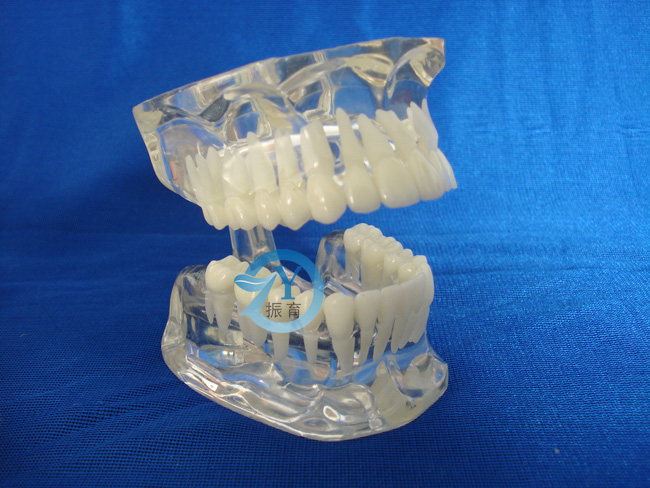 标准水晶牙列模型(德frassaco颌架)