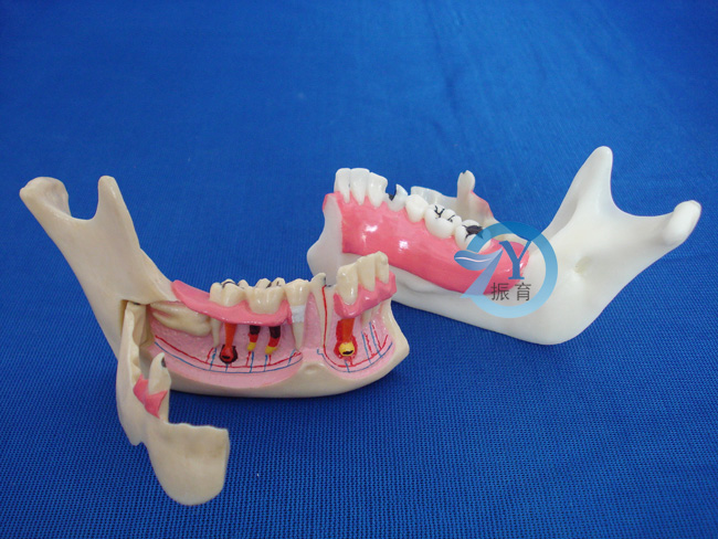 右侧下颌骨组织模型