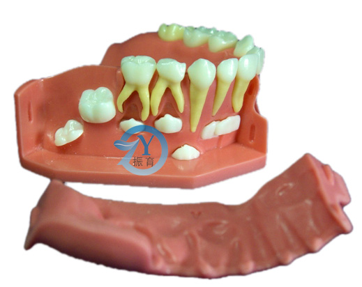牙列发育模型B
