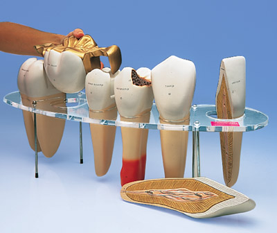 齿科形态学系列模型(实物的10倍)7部分-德文注释
