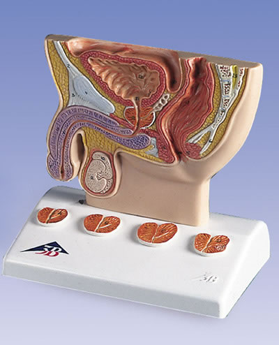 进口前列腺模型-实物1/2-德国3B-K41