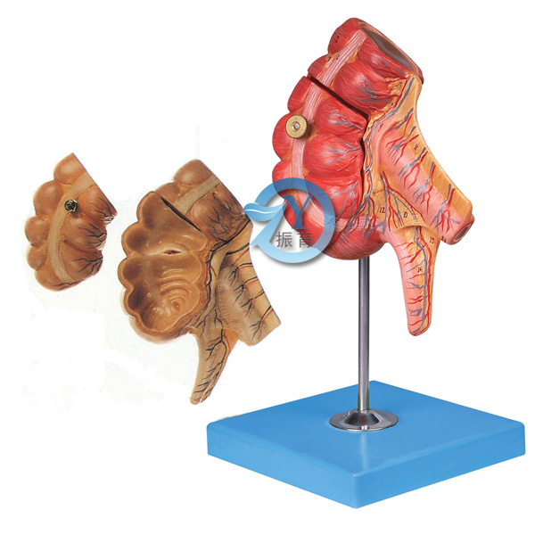 盲肠和阑尾模型